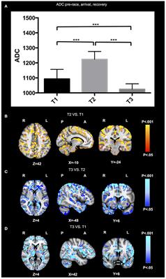 Extreme Mountain Ultra-Marathon Leads to Acute but Transient Increase in Cerebral Water Diffusivity and Plasma Biomarkers Levels Changes